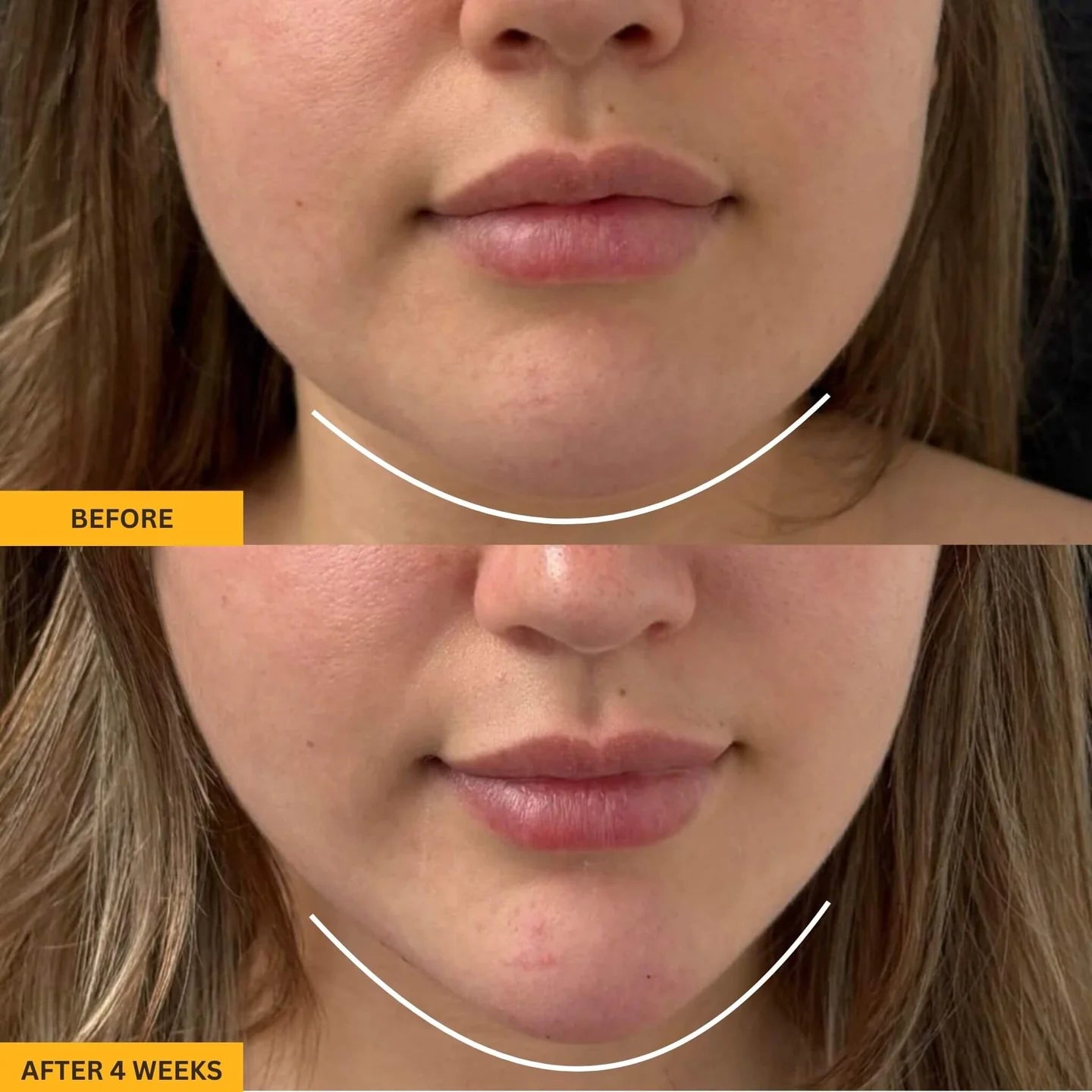 Lymphatic Brush for Snatched Face