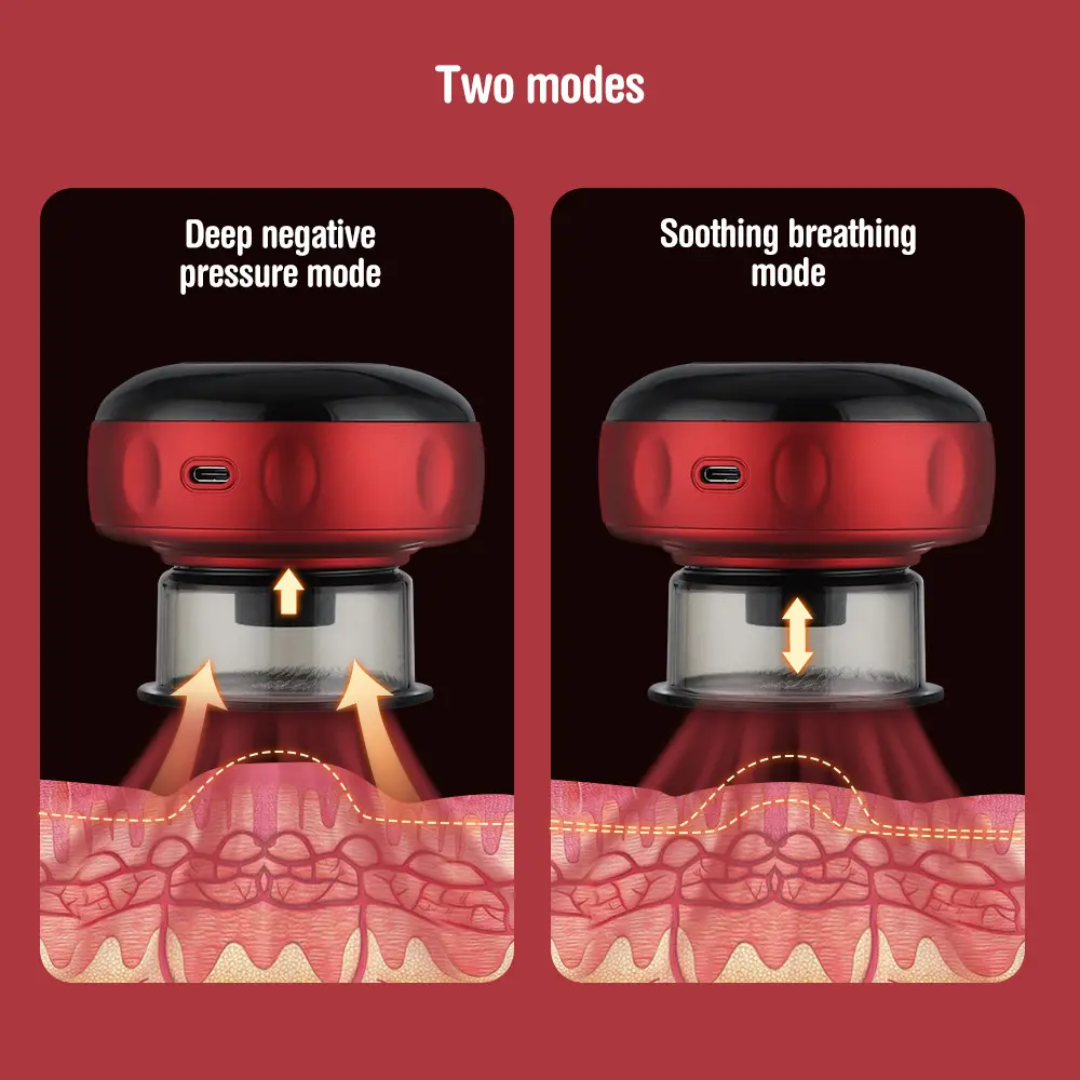 TheraCup™ Cupping Therapy Massager with Red Light & Dynamic Suction